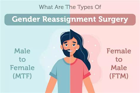 Sex Change Surgery 